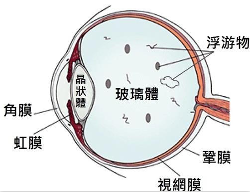 眼前有黑影、閃光感是怎么回事？
